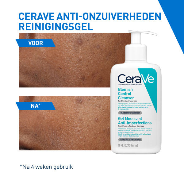 CeraVe Anti-Onzuiverheden Reinigingsgel - CeraVe - Huidproducten.nl