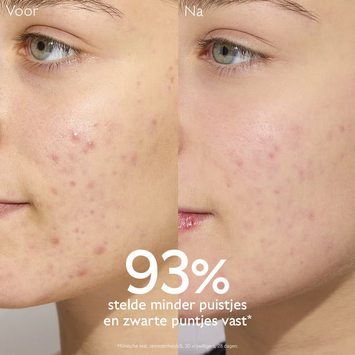 Caudalie Vinopure Fluide Anti Imperfections 40ml - Caudalie - Huidproducten.nl