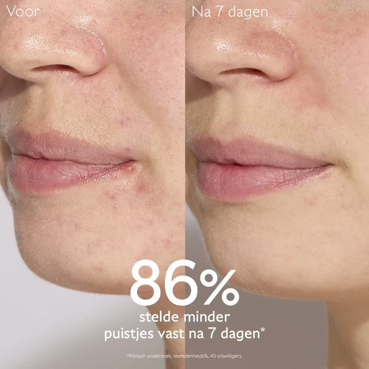 Caudalie Vinopure Serum Salicylique Anti-imperfections 30ml - Caudalie - Huidproducten.nl