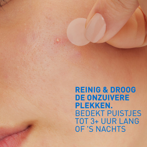 CeraVe Anti-Puistjes Patches - 22 patches - CeraVe - Huidproducten.nl