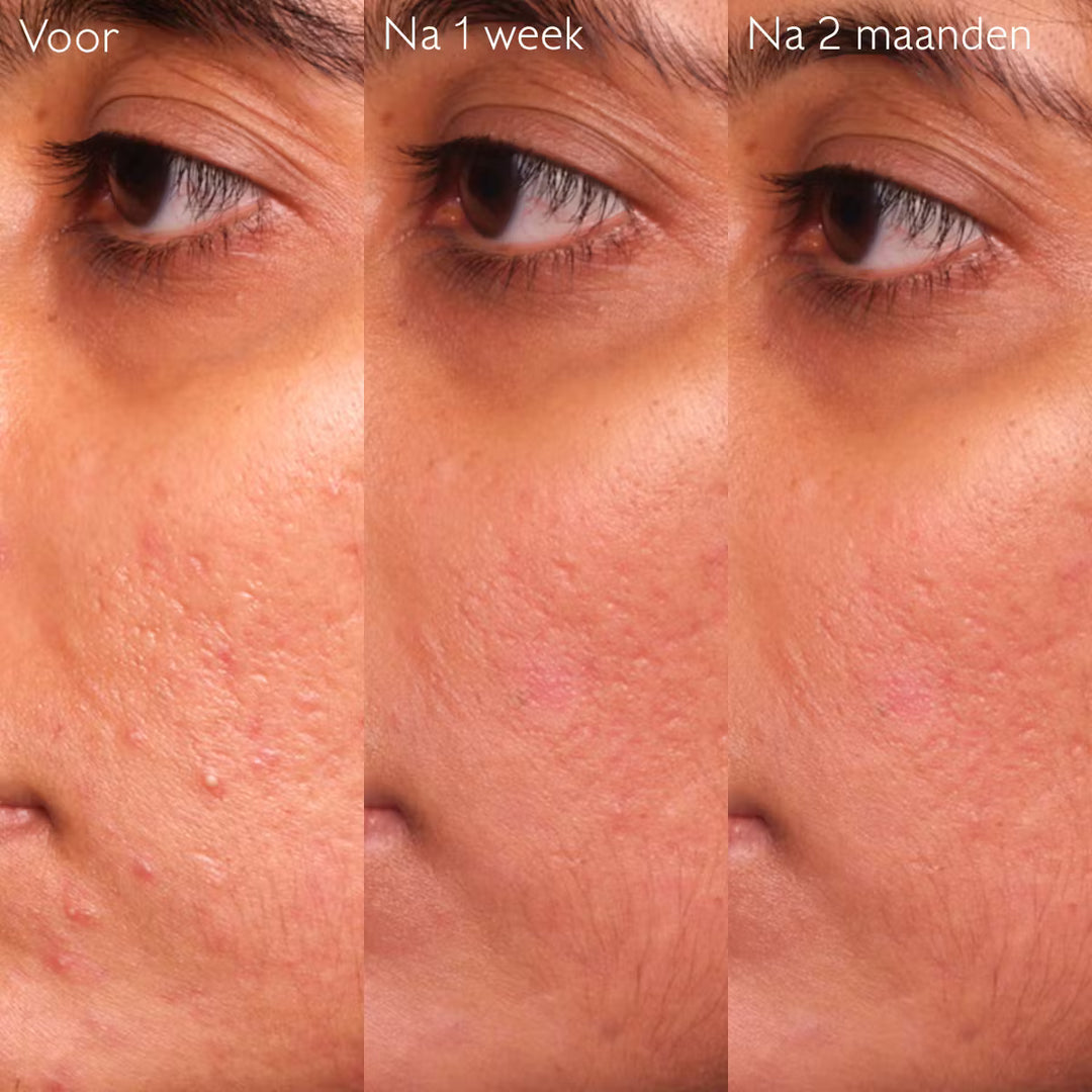 Caudalie Vinopure Serum Salicylique Anti-imperfections 30ml - Caudalie - Huidproducten.nl