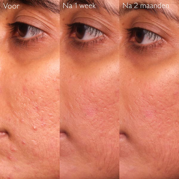 Caudalie Vinopure Serum Salicylique Anti-imperfections 30ml - Caudalie - Huidproducten.nl