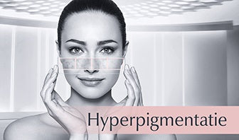 Eucerin Anti-Pigment Hyperpigmentatie