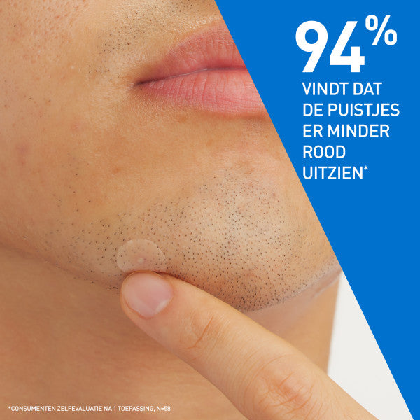 CeraVe Anti-Puistjes Patches - 22 patches - CeraVe - Huidproducten.nl