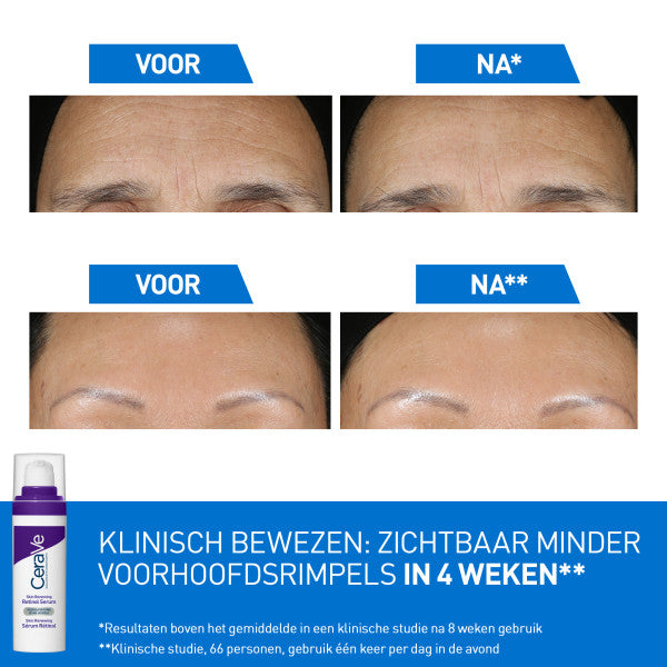 CeraVe Skin Renewing Retinol Serum - CeraVe - Huidproducten.nl