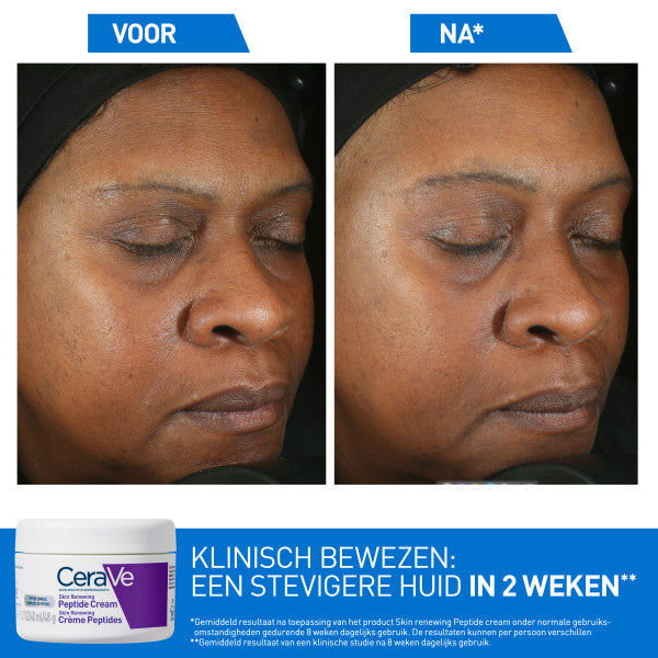 CeraVe Skin Renewing Peptide Crème - CeraVe - Huidproducten.nl